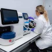 A Rentschler Biopharma team member conducting detailed analysis of upstream samples – an instrumental process in refining cell culture conditions.